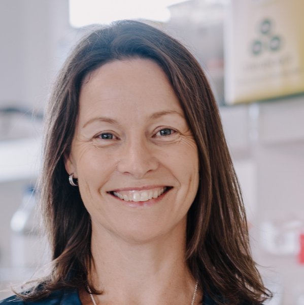 Continuing the Mission: Building on Professor Justin Yerbury’s vision for MND research Image
