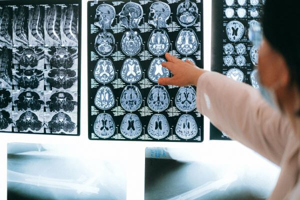 scientist examining brain scans